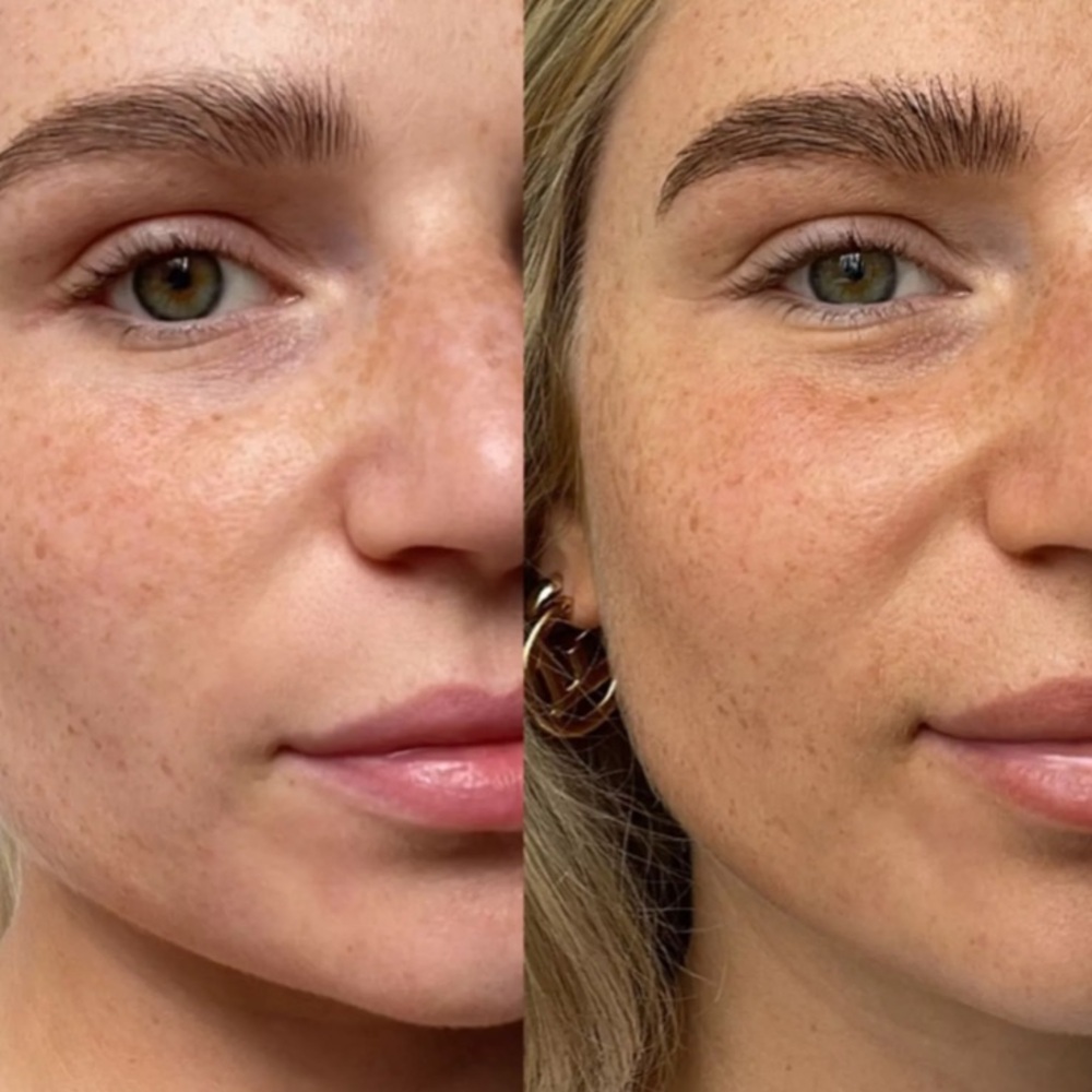 ⚫️ TAN-LUXE The Face Anti-Age Rejuvenating Self-Tan Drops Light/Medium Glow - Picture 3 of 5